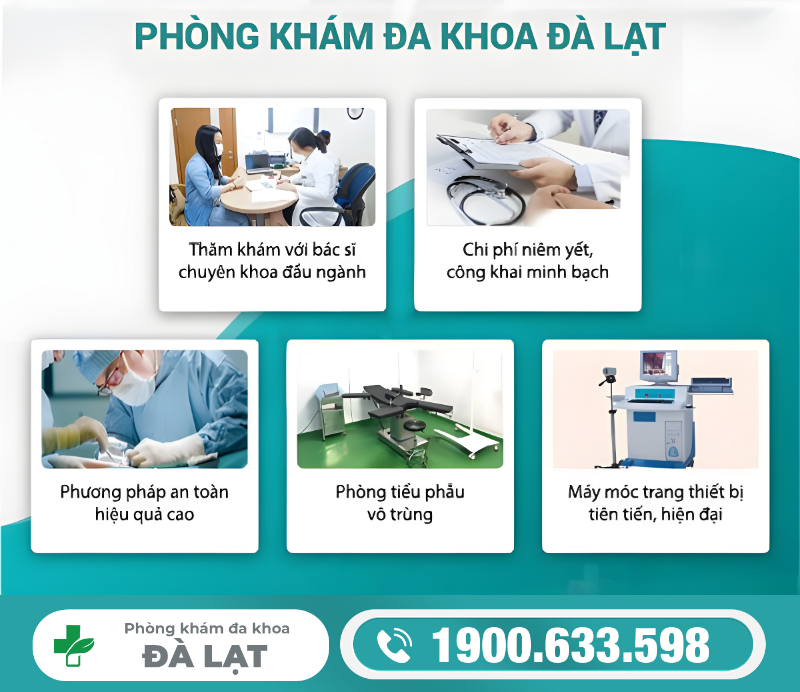 Hình ảnh minh họa